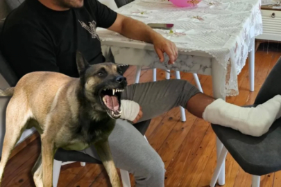 Köpek dehşeti! Bacağı 2 yerden kırıldı