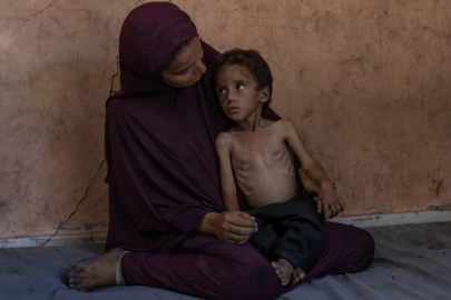 Gazze'de insanlık can çekişiyor! 86 kişi açlıktan öldü