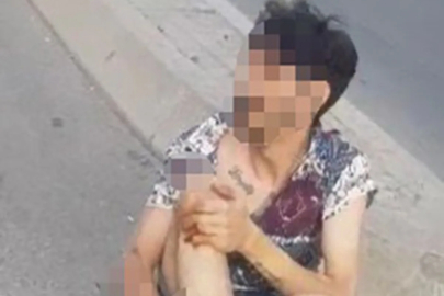 İstanbul Kadıköy'de motosiklet kazasında yaralanan genç feryat etti: Çok borcum var