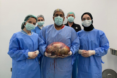 Doruk Hastanesi’ndeki başarılı operasyonla karnından 10 kiloluk kitle çıkarıldı