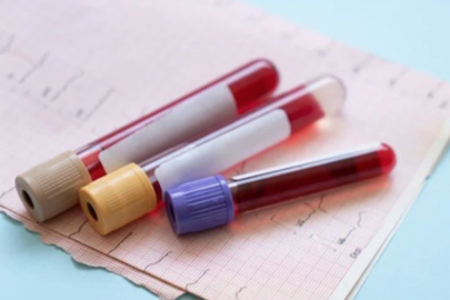 100 yaşını görmenin sırrı kan değerlerinde gizli