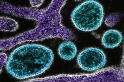 Chikungunya virüsü alarmı: Salgın büyüyor