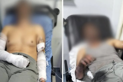 Manisa'da oto tamirhanesinde patlama: 2 kişi ölümden döndü