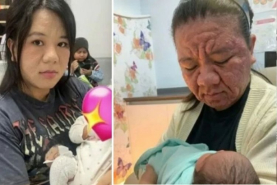 Eşi benzeri görülmemiş olay! Hamileliği sırasında onlarca yıl yaşlandı