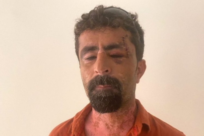 Babaevine dönen eşini takip edip kayın pederini darbetti!