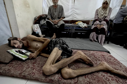 Gazze'de yardım arayışı yaşam mücadelesine dönüştü: İsrail'in saldırısında başından vuruldu