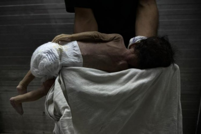 Gazze "açlıktan" ölüyor