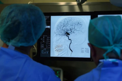 Erken müdahale, inme sonrası yaşam kalitesini artırıyor