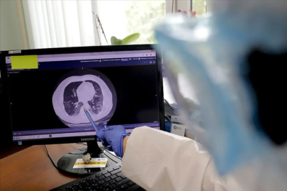 Sağlığı etkileyen sessiz tehdit: Magnezyum eksikliği