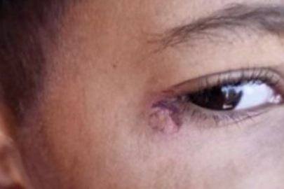 Kan donduran olay... Öğrencinin yüzünde sigara söndürdü!