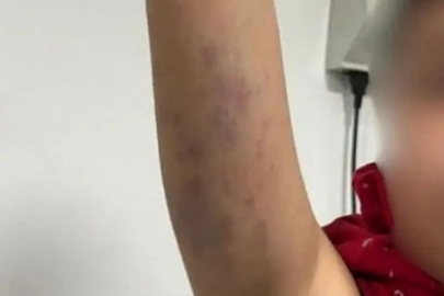 Okulda otizmli çocuğa şiddet skandalı! Gündemi sarsan olayla ilgili flaş gelişme