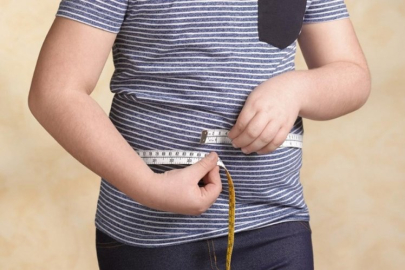 Obezite tedavisinde yeni dönem