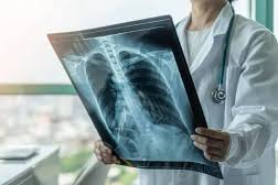 Koah Dünyada 3’üncü Ölüm Nedeni