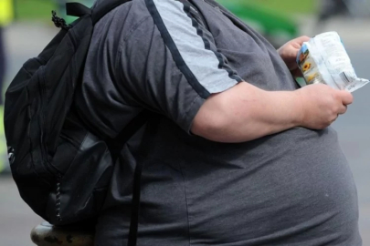DSÖ, dünya genelinde bir milyardan fazla kişinin obeziteyle yaşadığını bildirdi
