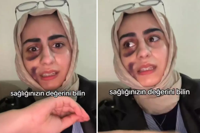 Stajyer doktora tedavi olan kadın video çekip isyan etti