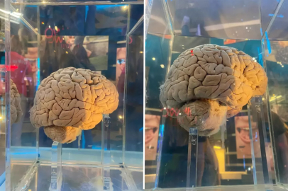 Amsterdam'daki dev arşiv: 5 bin 300 beyin yapay zeka ile haritalanacak