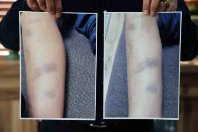 Diyarbakır'da özel okulda 8 yaşındaki çocuğun darbedildiği iddiası