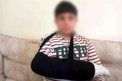 Ankara'da ortaokul öğrencisi, kendisinden 3 yaş küçük öğrencinin parmağını kırdı