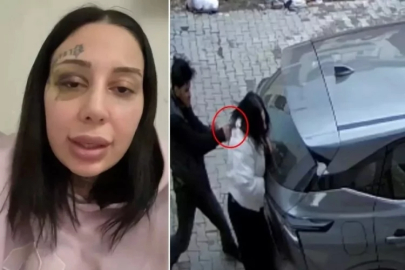 Sokak ortasında dehşeti yaşattı: Tecavüze uğradım...