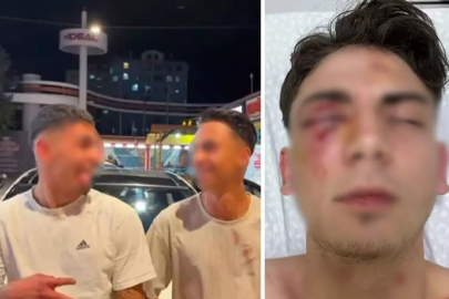 Muştalarla döverek kör ettiler, ellerinde kan ile video çektiler! 1,5 ayda tahliye olan şüpheliler yeniden gözaltında