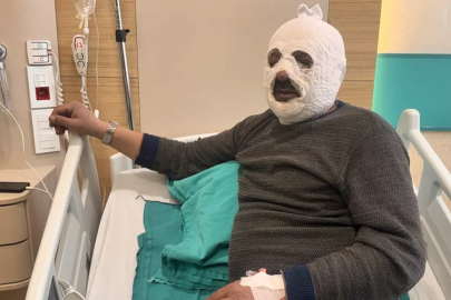 Kalorifer yakarken canından oluyordu!