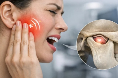 Çeneden gelen ses göz ardı edilirse çene kayması kronikleşebiliyor