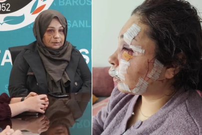 Eşini bu hale getiren Cumhurbaşkanı Koruma Dairesi personeli tutuklandı