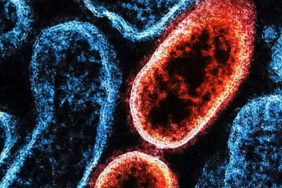 Kovid-19'dan çok daha ölümcül! | Nipah virüsü nedir, belirtileri nelerdir? Nipah Virüsü yeni bir pandemiye neden olacak mı?