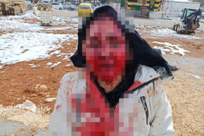 Boşanma aşamasındaki eşini feci şekilde darp etti! Korkunç görüntüler...