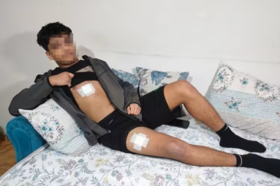 Akran zorbalığı az kalsın öldürüyordu! Önce dövüldü sonra bıçaklandı