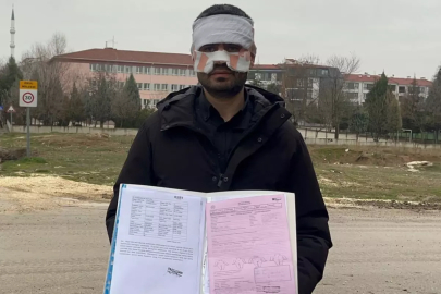 Rehber öğretmenin yüzüne sıcak çay fırlattığı fizik öğretmeni feci şekilde yandı