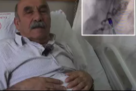 Göğüs yanması şikayetiyle gittiği hastanede kalbinden kan 'çalan' damar bulundu