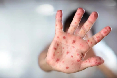 Başkentte salgın alarmı! 7 okul harekete geçti..