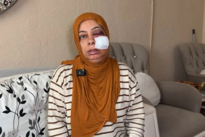 Hatay'da elektrikli bisikletten düşen kadının yüzüne 14 dikiş atıldı