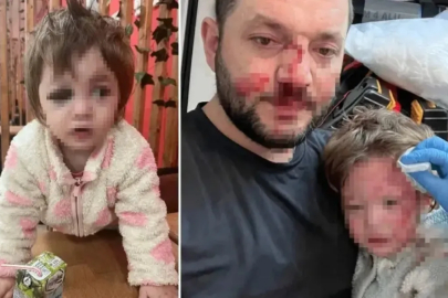 Yalova'da 14 aylık İkra darp edilmişti! Olayla ilgili detaylar ortaya çıktı...