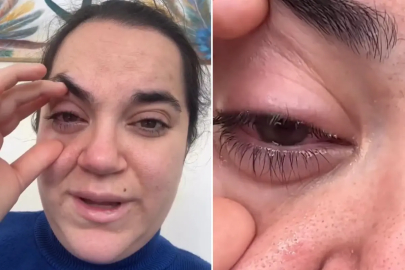 Bulaşık makinesi tableti kadının gözüne patladı, kör olma korkusu yaşadı