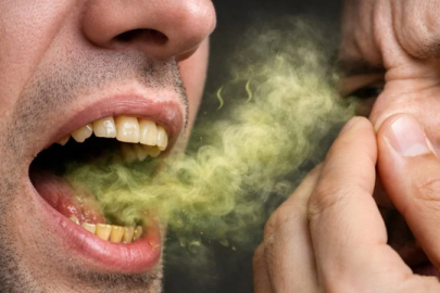 Kötü nefes kokusunun gerçek sebepleri: İşte 6 ihtimal