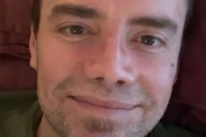 Murat Dalkılıç'ın son hali: Burun bandajları çıktı