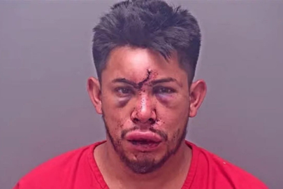 13 yaşındaki çocuk, evdeki olayı görünce babasını bu hale getirdi