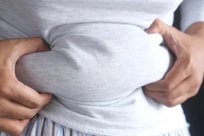 Kadınlardaki şişkinlik hissi yalnızca beslenmeden kaynaklanmıyor