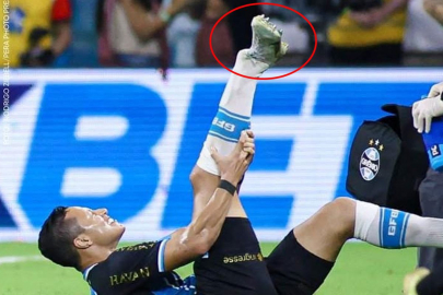 Süper Lig'in eski yıldızı ayağını kırdı! Acı içinde kaldı dakikarca kıvrandı