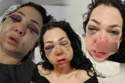 Türkiye bu olayı konuşuyor! Anne ve oğlunu feci şekilde darp ettiler...