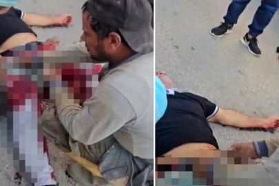 Husumetlisini kasığından vurdu!