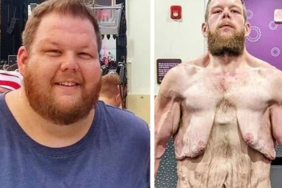 163 kilo verdi ama çilesi bitmedi