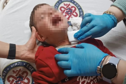 Cani, 2 yaşındaki bebeği hedef aldı!