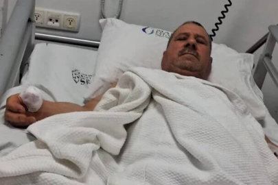 Başıboş köpek dehşet saçtı! Talihsiz adam parmağından oldu...