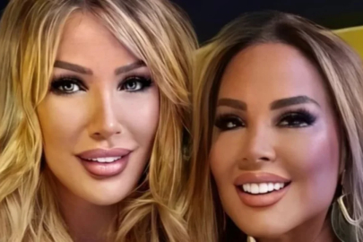 Safiye Soyman yine estetik yaptırdı! Yüzünü gerdirip gıdığını aldırdı