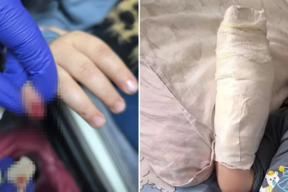 AVM'de 3 yaşındaki çocuğun parmağı koptu! Hiç beklemediği yerden geldi...