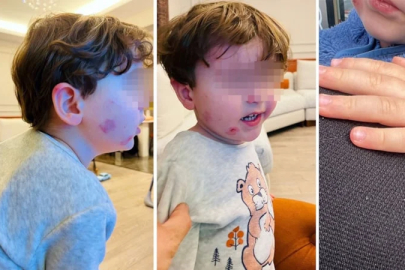 Bursa'da kreşe sağlam giren çocuk, akşam darbedilmiş halde çıktı