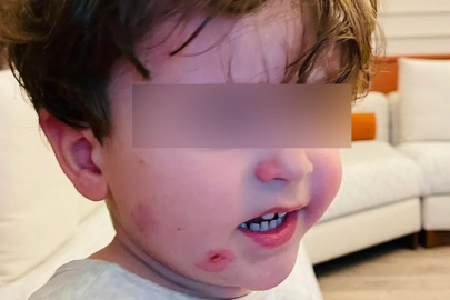 Bursa'da özel kreşte skandal iddia! 2,5 yaşındaki çocuk darp edildi...